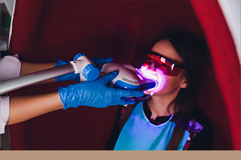 BClinic - Dental Clinic - Services - Gum Contouring