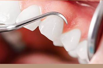 BClinic - Dental Clinic - Services - Gum Craft
