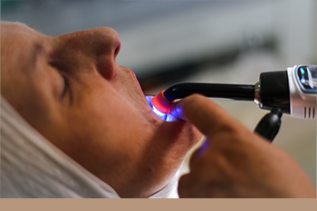 BClinic - Dental Clinic - Services - Crown Lengthening