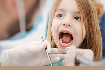 BClinic - Dental Clinic - Services - Dental Fillings