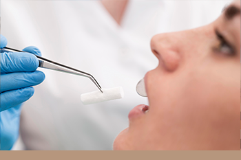 BClinic - Dental Clinic - Services - Wisdom Teeth And Diseased Tooth Surgical Extractions