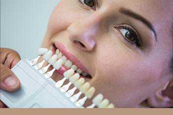 BClinic - Dental Clinic - Services - Veneer